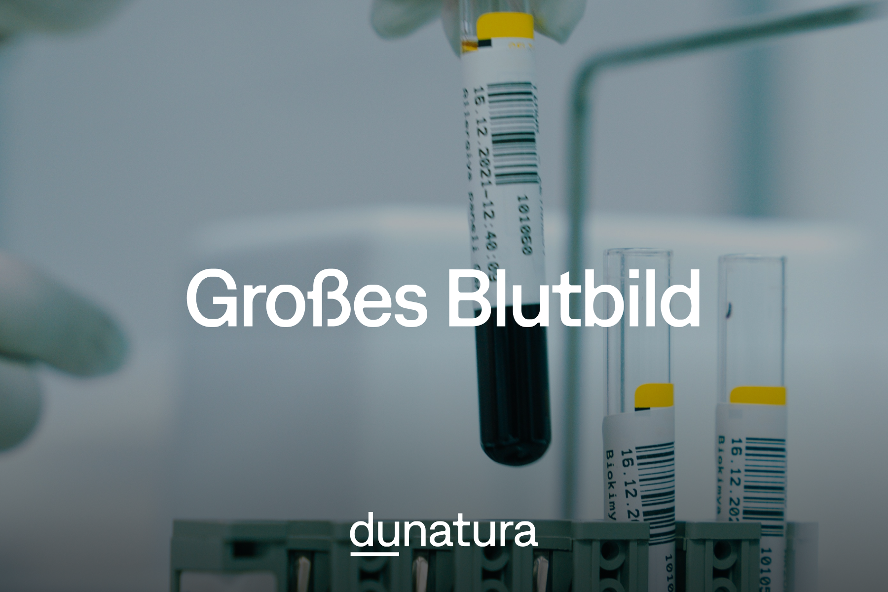 Wie Viel Kostet Grosses Blutbild